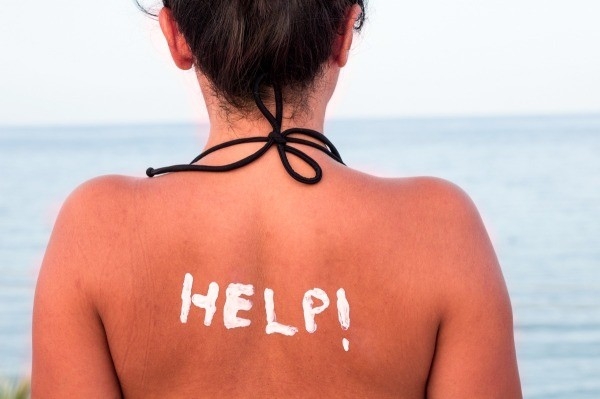 Natural Remedies to Treat Sunburn