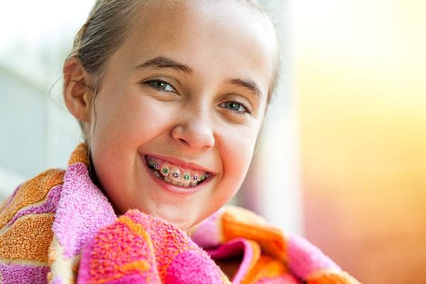 4 Significant Advantages of Using Braces  