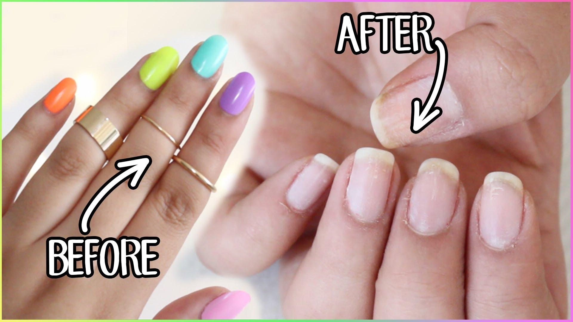 How to Take Acrylic Nails off at Home