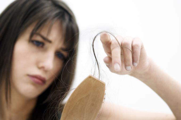 Hair Loss During Pregnancy: Telogen Effluvium