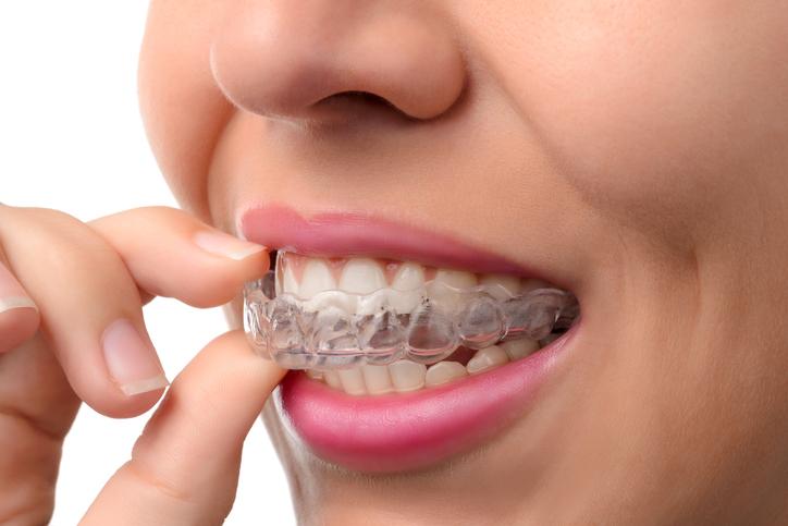 How To Choose A Dentist For Your Emergency Situation?
