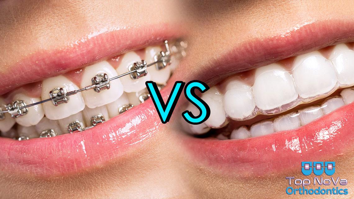 How is Orthodontics The Best Choice For Oral Health