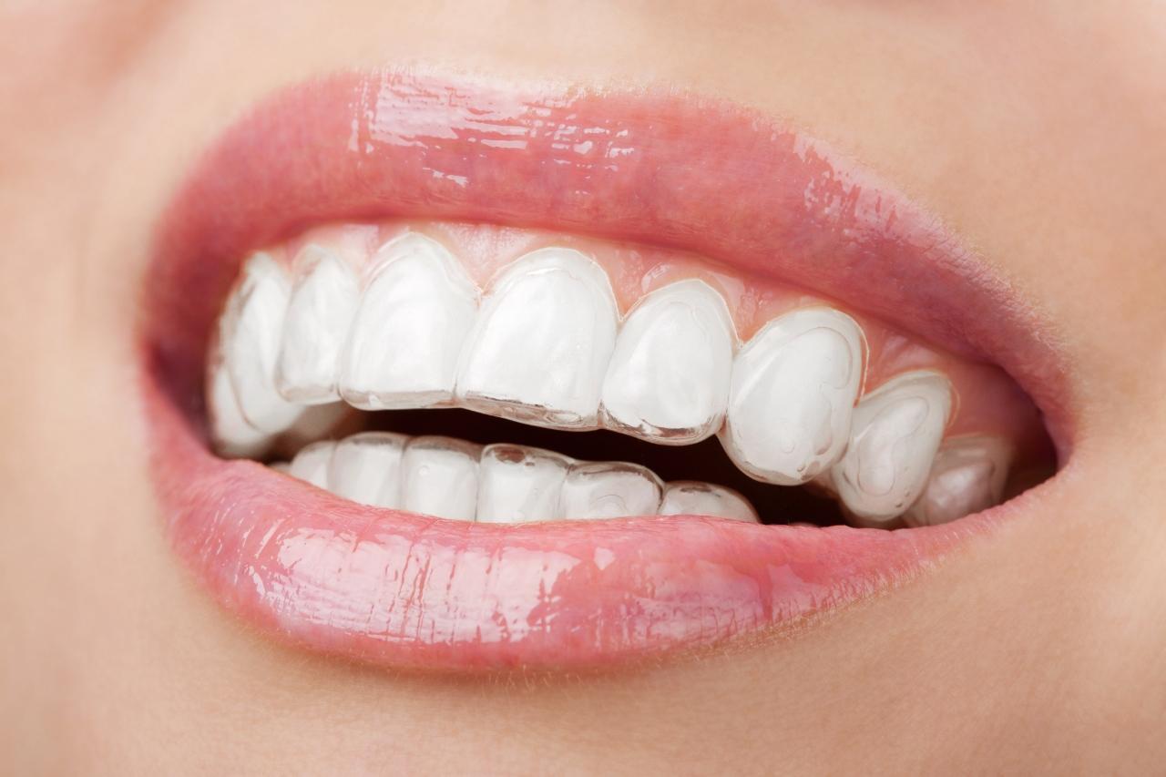 Cosmetic Dentistry Procedures to Generate Enhanced Appearance