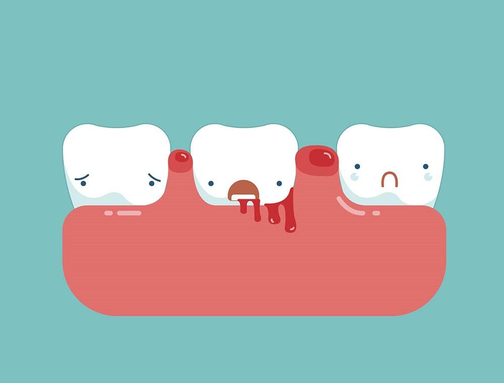 Do you have good dental etiquette? 11 Do’s and Don’ts