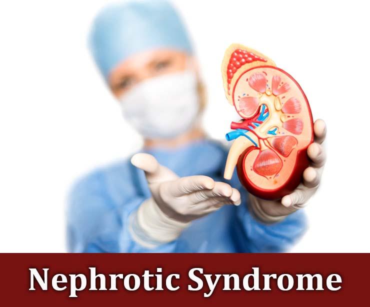 What is nephrotic syndrome?