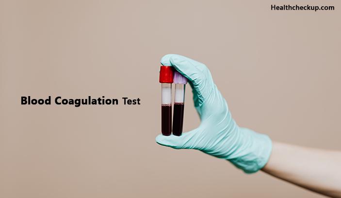 What Is Coagulation Test And How It Is Done?