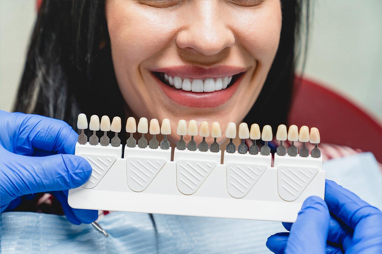 Here is What You Need to Know About Laminate Veneers