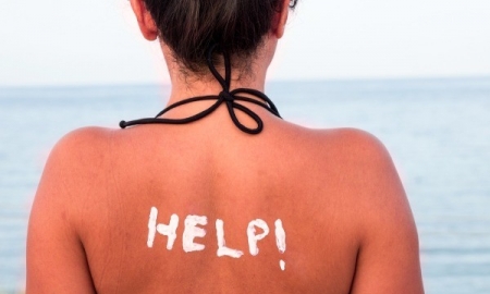 Natural Remedies to Treat Sunburn