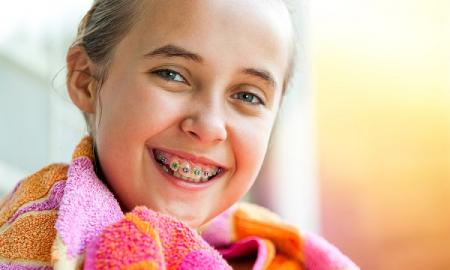 4 Significant Advantages of Using Braces  