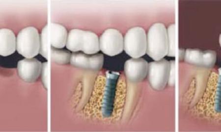 7 Types of Dentists That You Should Consult for Different Reasons 