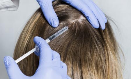 Side Effects of Most Common Hair Regrowth Products