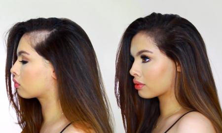 Postpartum Hair Loss: Everything You Need to Know About Losing Hair