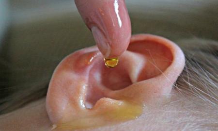 The best 6 ways to treat Hearing Loss Naturally?