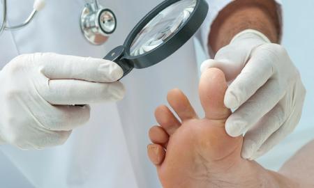 Why Diabetic Foot Care is so Important
