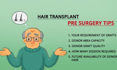 Top Things to Consider before having a Hair Transplant