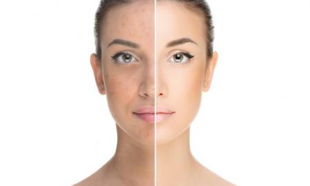 These Beauty Mistakes Are Ruining Your Skin