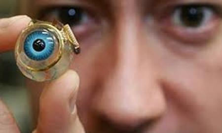 Bionic Eye Implants a step beyond prosthetic eyes