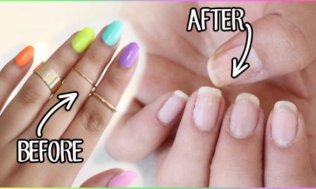How to Take Acrylic Nails off at Home