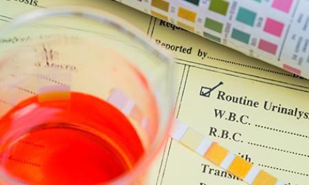 The cost of drug and alcohol abuse in the workplace