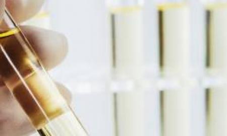 Reporting and Record Keeping Procedures for Employee Drug Testing
