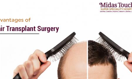 Advantages of Hair Transplant Surgery