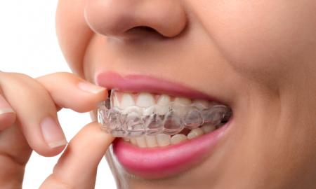 How To Choose A Dentist For Your Emergency Situation?