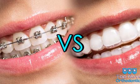 How is Orthodontics The Best Choice For Oral Health
