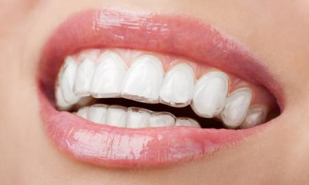 Cosmetic Dentistry Procedures to Generate Enhanced Appearance