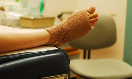 Common Signs You Might Have a Bunion